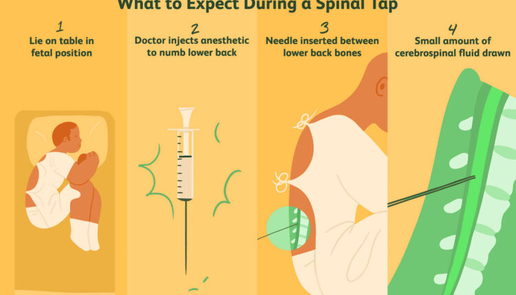 Lumbar puncture