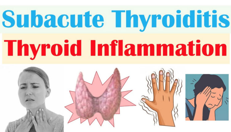 De Quervain's (subacute) thyroiditis