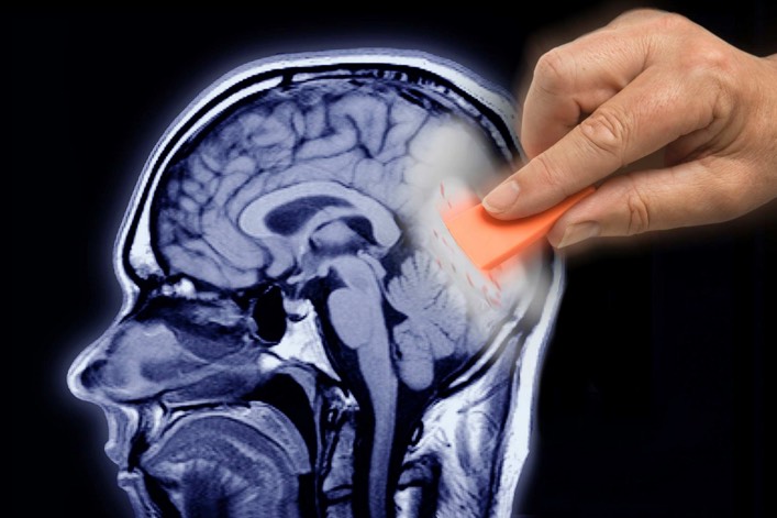 فراموشی گذرای فراگیر (Transient Global Amnesia - TGA)