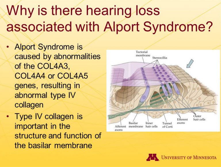 سندرم آلپورت alport syndrome