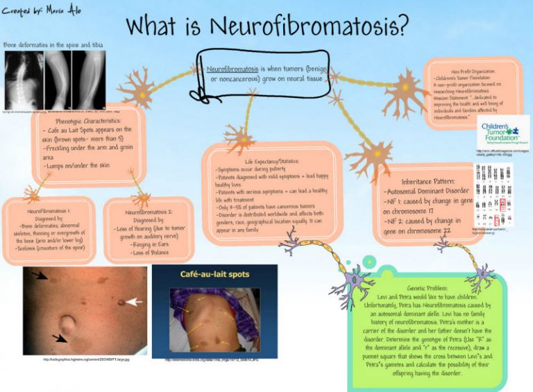 Neurofibromatosis