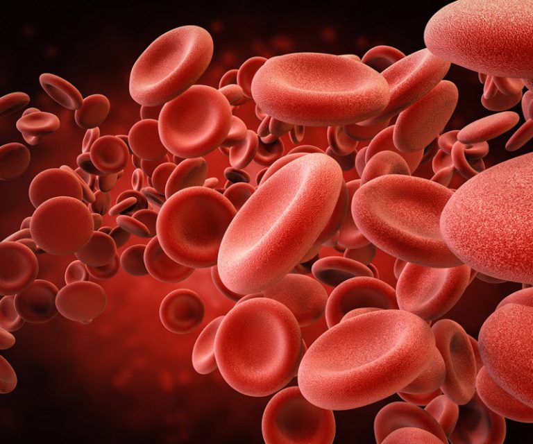 Iron deficiency anemia