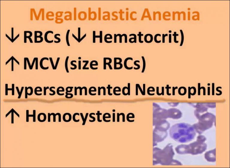 Megaloblastic anemia