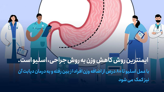 عمل اسلیو معده