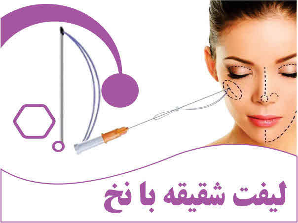 تصویر لیفت شقیقه با نخ