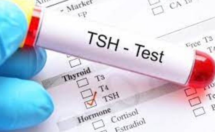 آزمایش TSH
