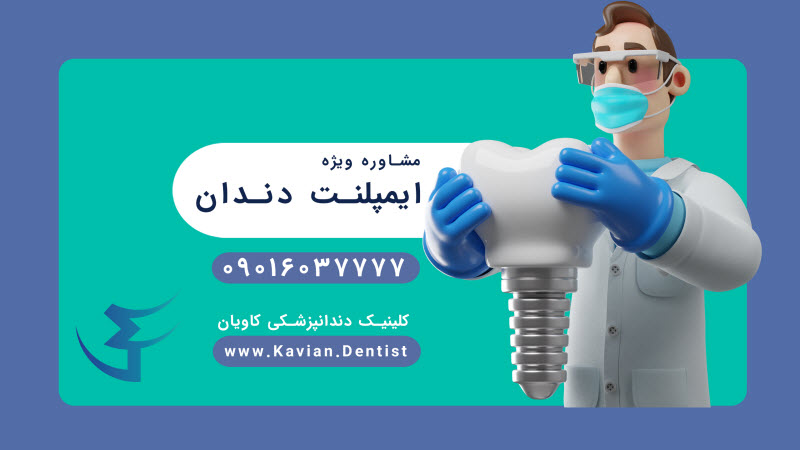 مشاوره رایگان ایمپلنت دندان