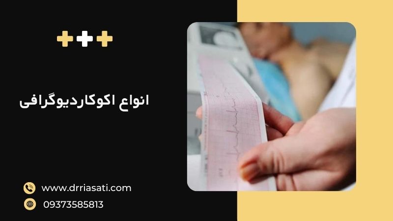 انواع اکوکاردیوگرافی