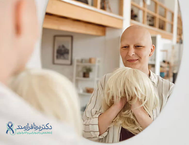 ریزش مو در شیمی درمانی