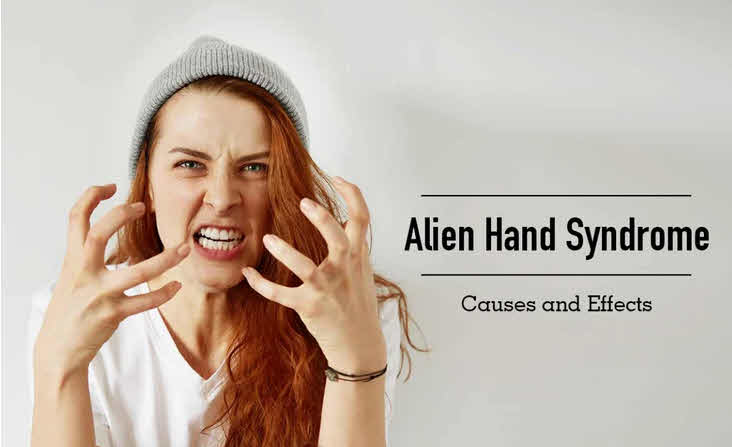 Alien Hand Syndrome