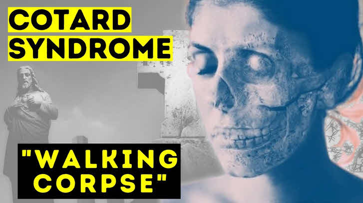 Walking Corpse Syndrome (Cotard's Syndrome)