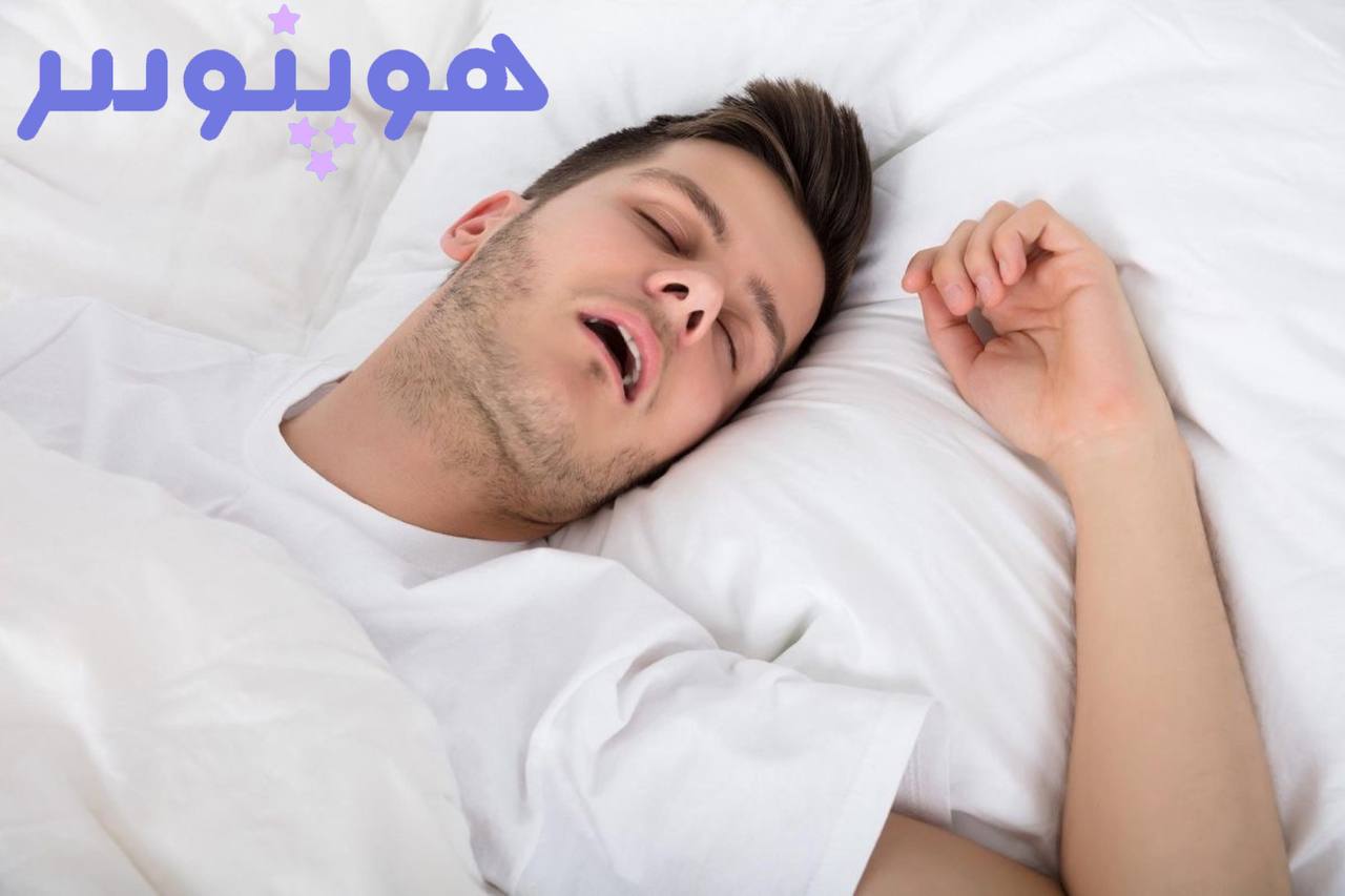 درمان خروپف