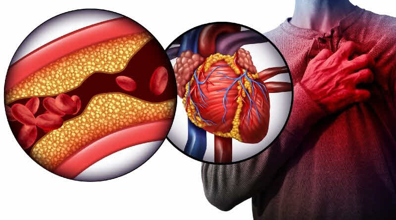 متخصص آریتمی قلب