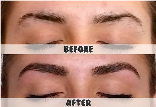 کاشت ابروی طبیعی پرپشت