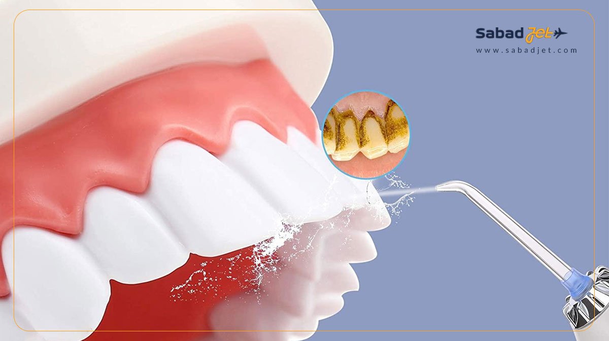 مزایای استفاده از واترجت
