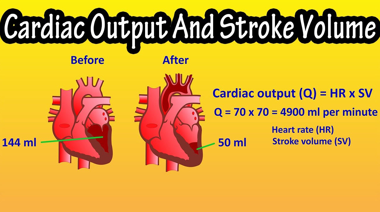 برونده قلبی (Cardiac Output)