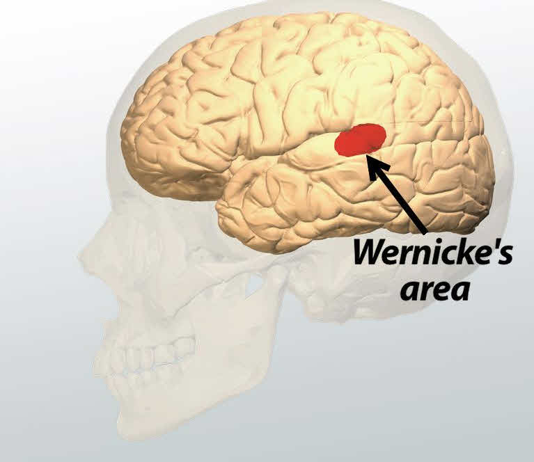 آناتومی و عملکرد ورنیکه مغز Wernicke's Area