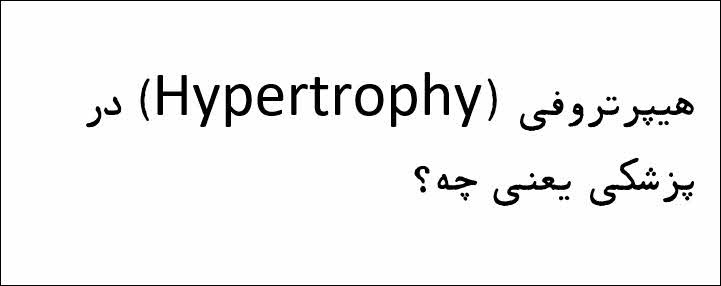 هیپرتروفی (Hypertrophy)