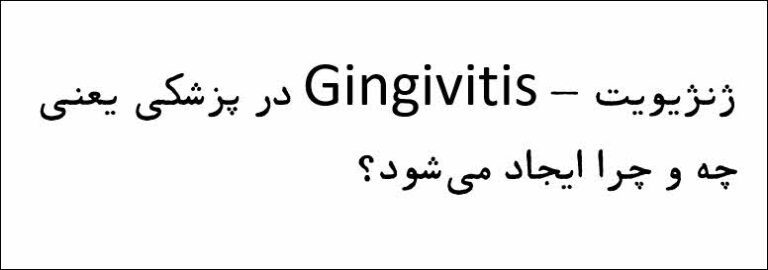 ژنژیویت - Gingivitis