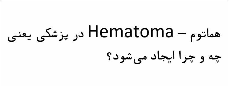 هماتوم - Hematoma