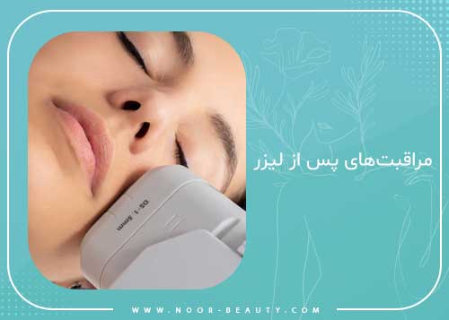 مراقبت‌های پس از لیزر
