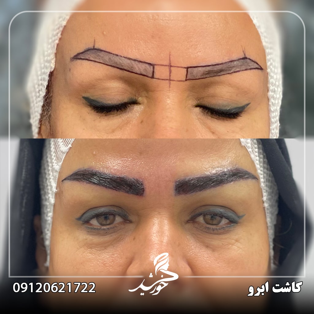 جمع بندی کاشت ابرو و تاتو