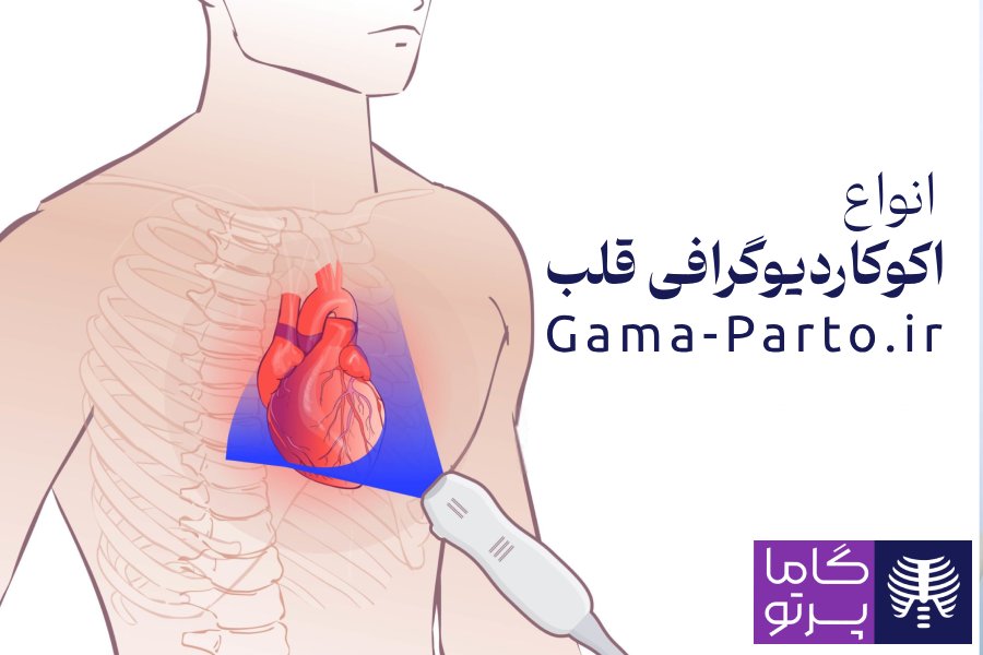 انواع اکوکاردیوگرافی قلب - گاما پرتو