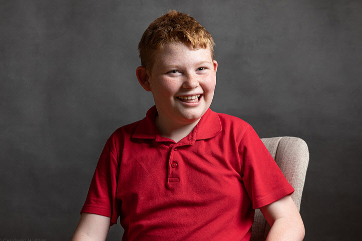 سندرم فرشته (Angelman Syndrome)