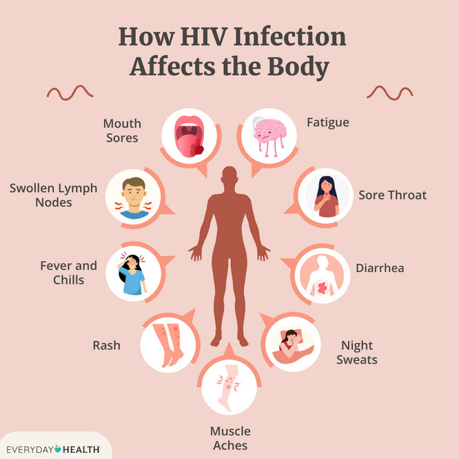 عفونت با HIV و بیماری ایدز