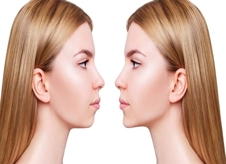 تاثیر ارتودنسی در کنار جراحی فک