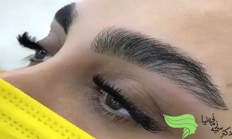 برای کاشت ابرو چه نکاتی در نظر بگیریم