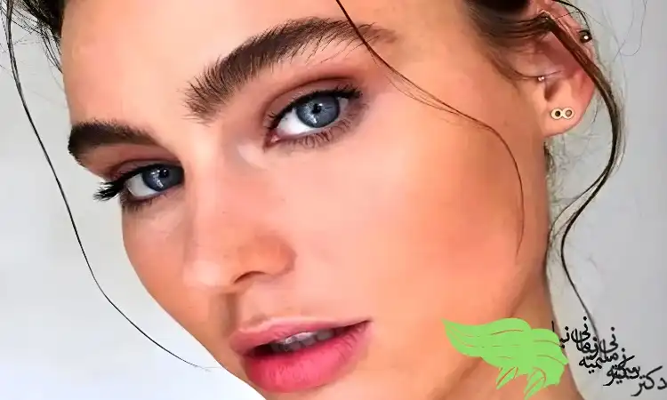 استفاده از روش fue برای کاشت ابرو