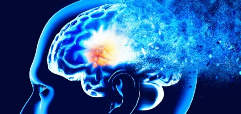 این ۱۵ عامل باعث می‌شوند احتمال ابتلا شما به آلزایمر زودرس افزایش پیدا کند