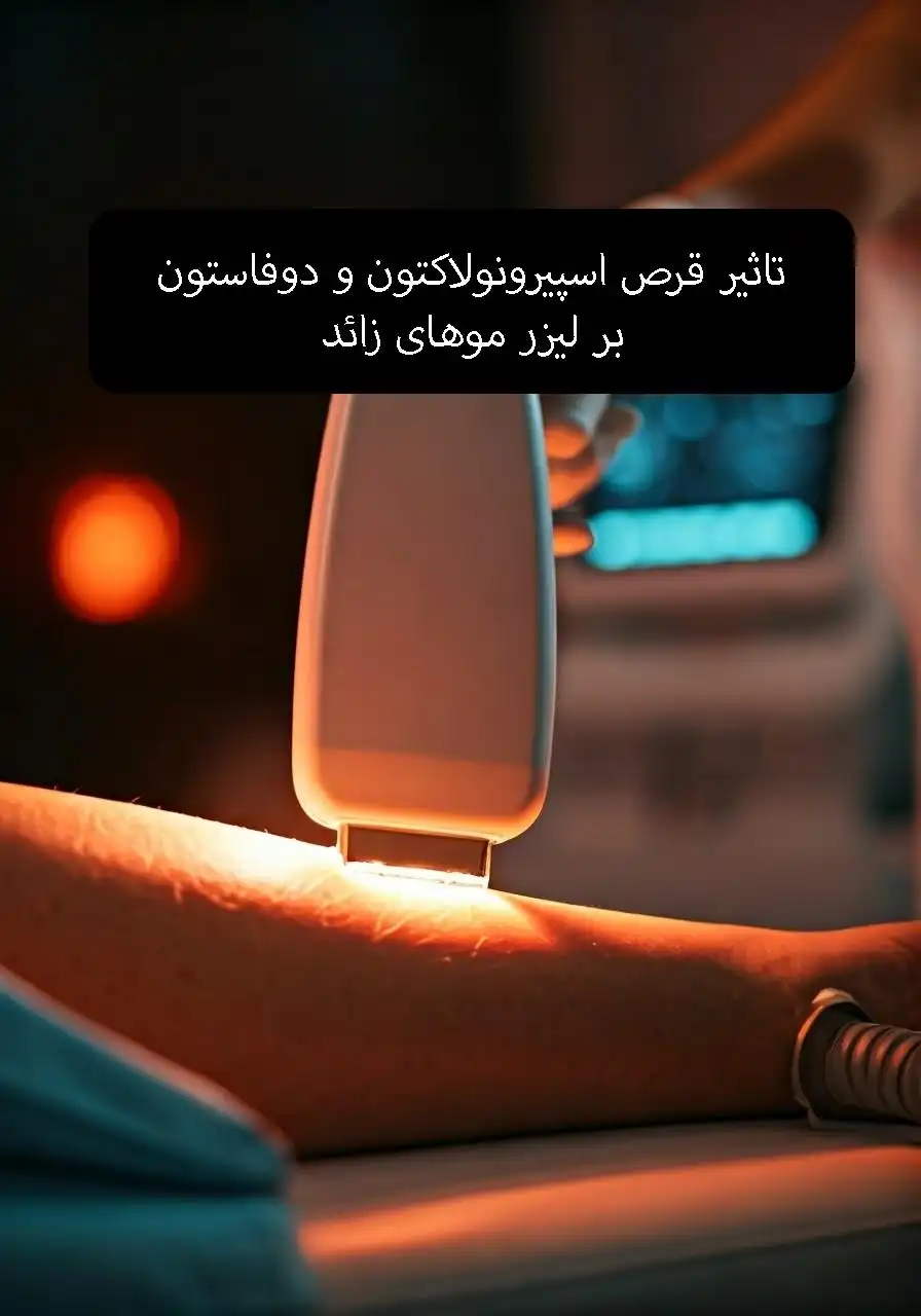تصویر تاثیر قرص بر لیزر موهای زائد
