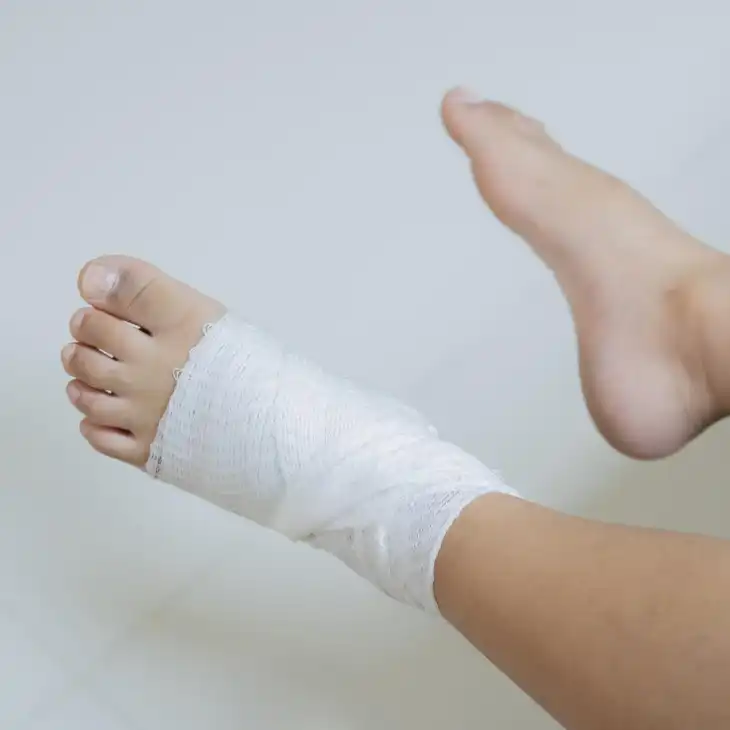 پای بانداژ شده