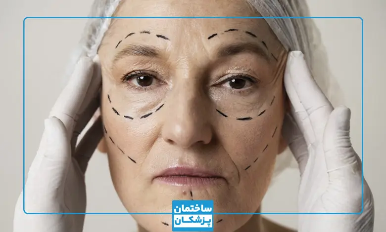 جراحی لیفت صورت