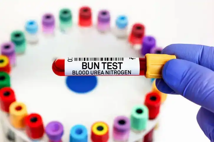 نیتروژن اوره خون (BUN)