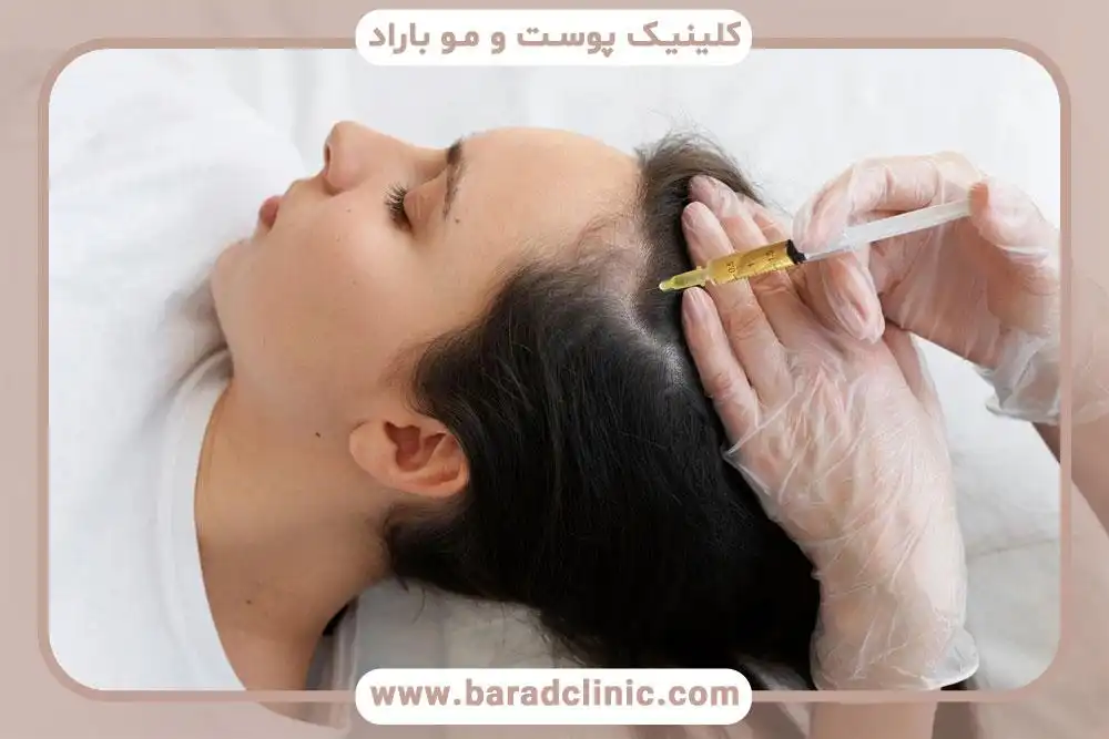کاشت مو طبیعی