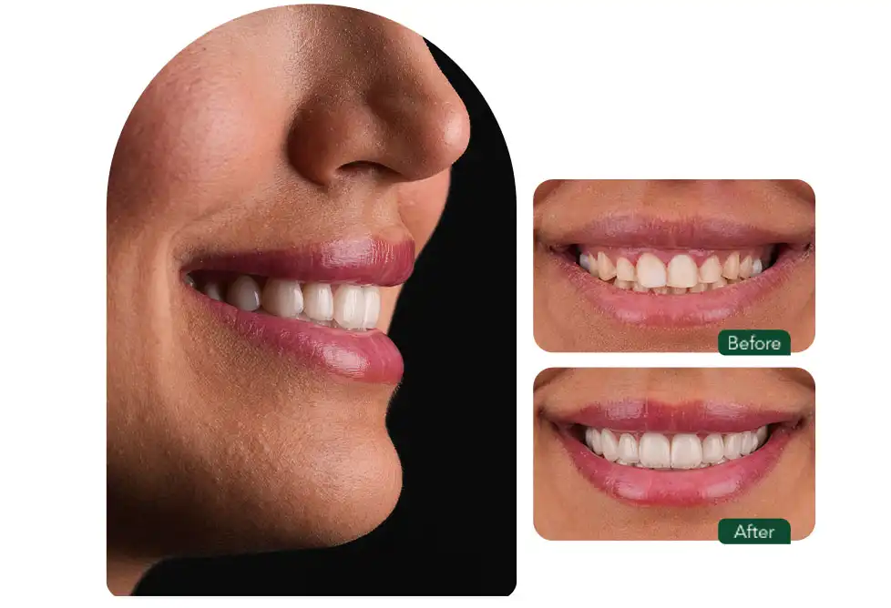 نمونه کار لمینت مشهد