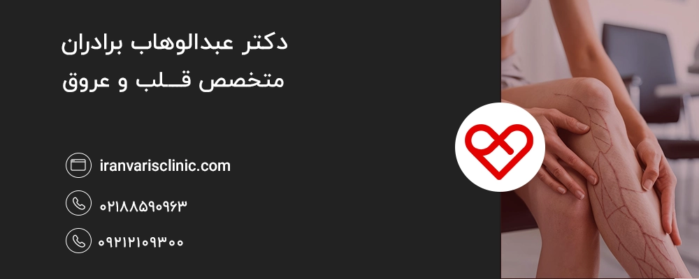 روش ‌های جایگزین وازلین برای درمان واریس