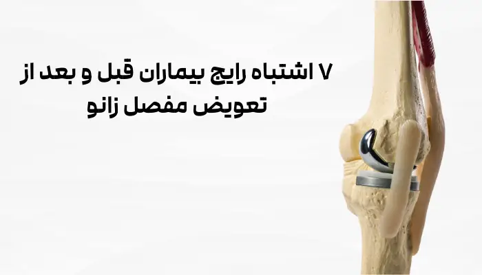 اشتباهات قبل و بعد از جراحی تعویض مفصل زانو