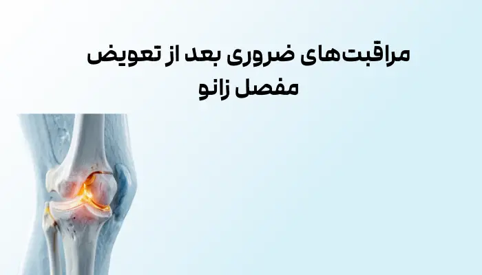 مراقبت های ضروری بعد از تعویض مفصل زانو