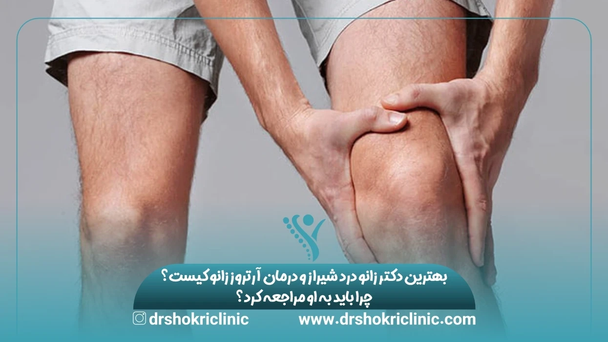 بهترین دکتر زانو درد شیراز و درمان آرتروز زانو کیست؟ چرا باید به او مراجعه کرد؟