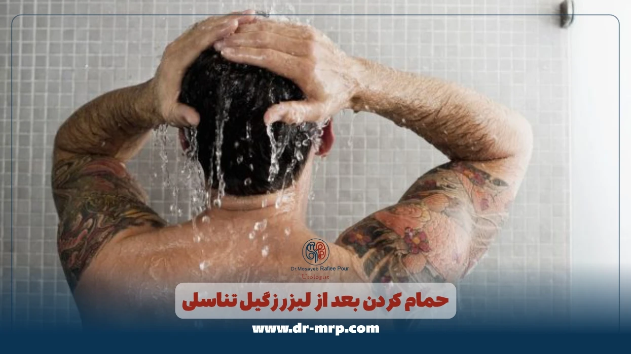 حمام کردن بعد از لیزر زگیل تناسلی