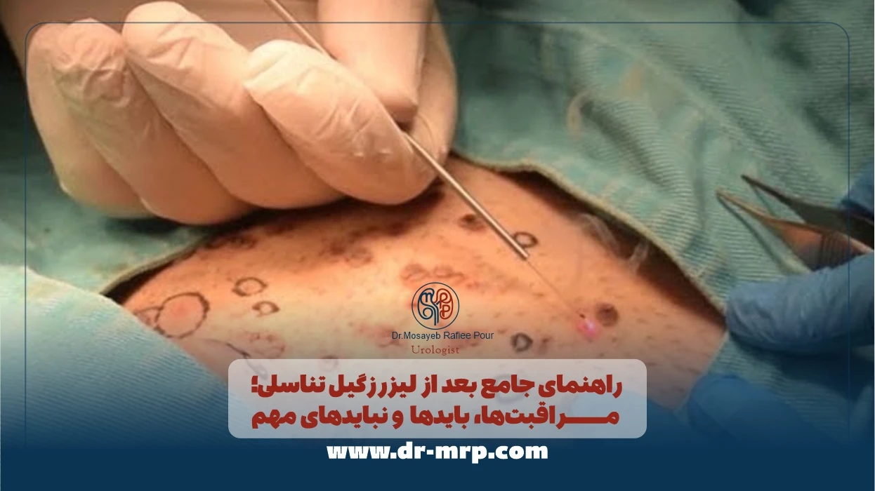 راهنمای جامع بعد از لیزر زگیل تناسلی؛ مراقبتها، بایدها و نبایدهای مهم