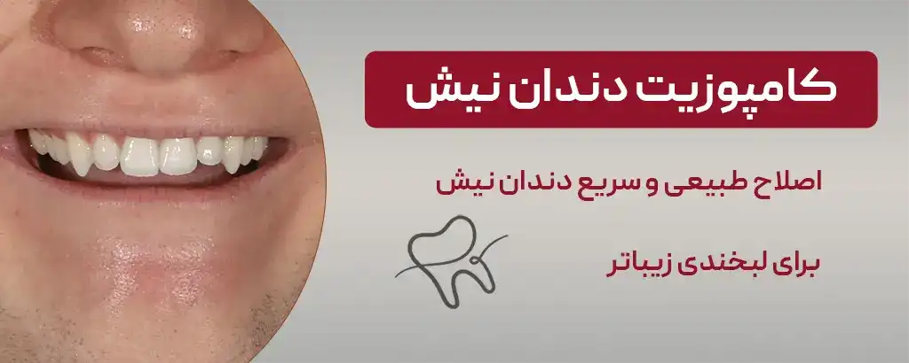 کامپوزیت دندان نیش تیز
