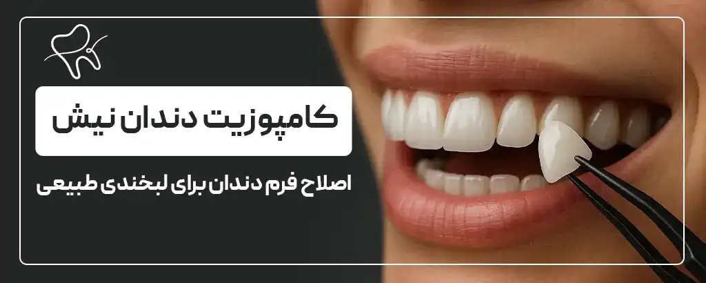 کامپوزیت دندان نیش