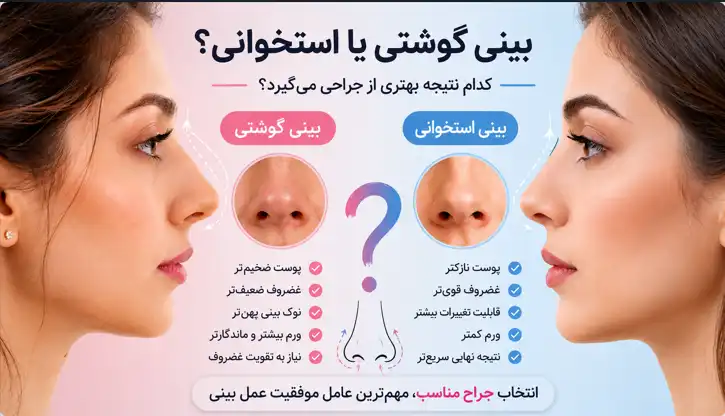 بینی گوشتی یا استخوانی؟