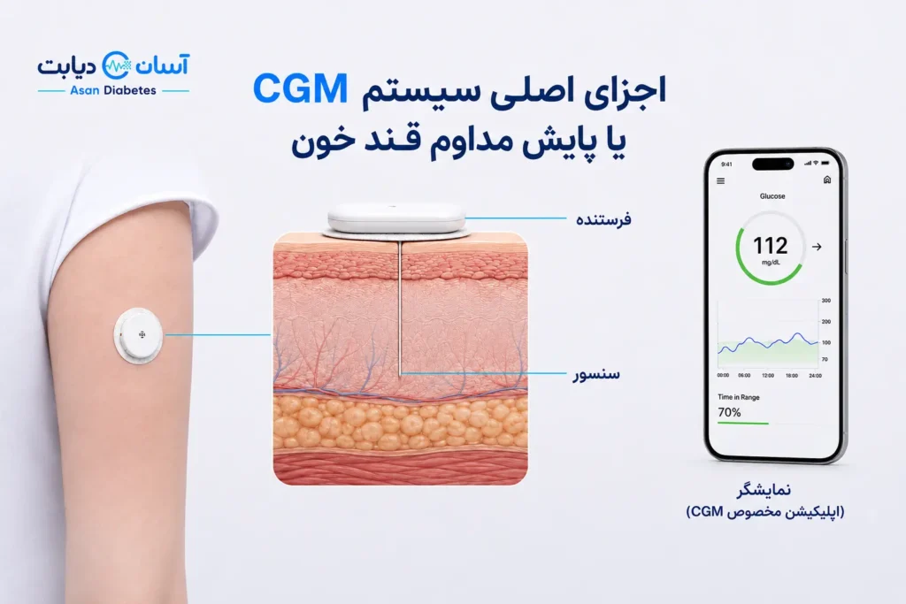 آسان دیابت فروش سنسور قند خون در ایران