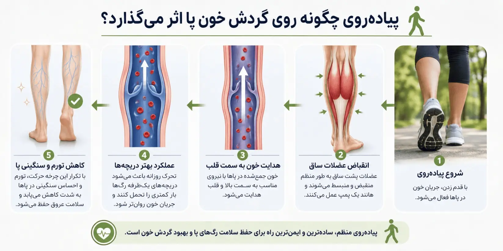 پیاده روی و واریس